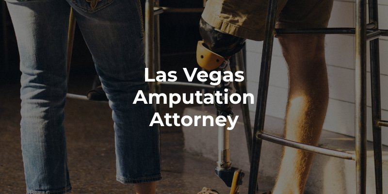 Las Vegas Amputation Attorney