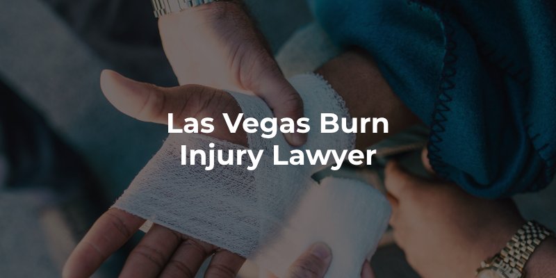 Las Vegas Burn Injury Lawyer 