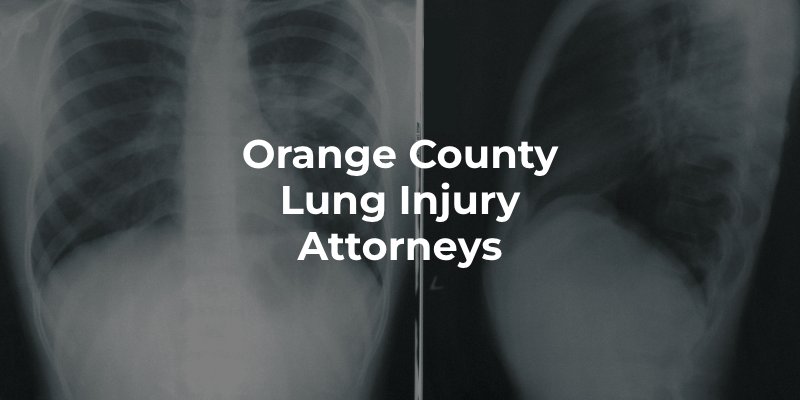 Orange County Lung Injury Attorneys